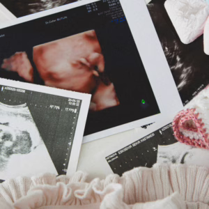 Ultrasound Photos with Baby Clothing and Accessories